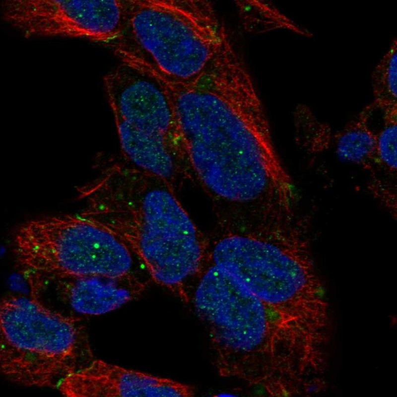 Anti-DLX1 Antibody
