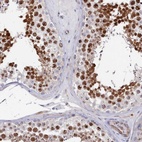 Anti-TIGD4 Antibody