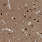 Immunohistochemical staining of human cerebral cortex shows high expression.