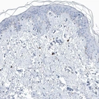 Immunohistochemical staining of human skin shows low expression as expected.