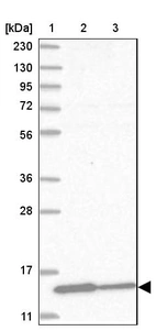 Lane 1: Marker [kDa] 230, 130, 95, 72, 56, 36, 28, 17, 11_br/_Lane 2: Human cell line RT-4_br/_Lane 3: Human cell line U-251MG sp