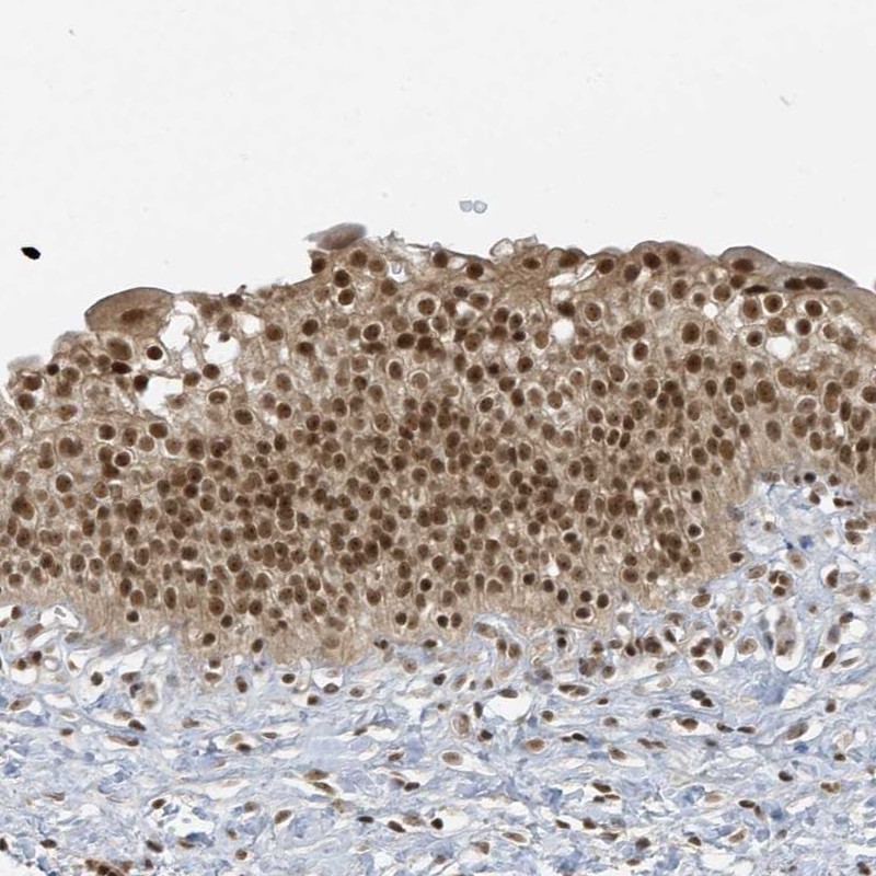 Anti-ZNF740 Antibody