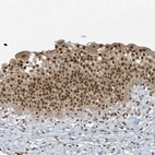 Anti-ZNF740 Antibody