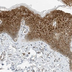 Immunohistochemical staining of human skin shows strong nuclear and cytoplasmic positivity in squamous epithelial cells.