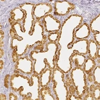 Immunohistochemical staining of human lactating breast using Anti-CSN1S1 antibody HPA035659.
