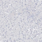 Immunohistochemical staining of human liver shows low expression as expected.