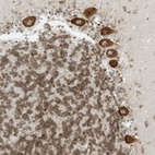 Immunohistochemical staining of human cerebellum shows strong nuclear and cytoplasmic positivity in Purkinje cells.