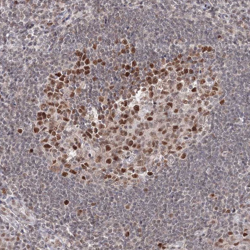 Anti-IWS1 Antibody