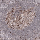 Anti-IWS1 Antibody
