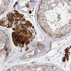 Anti-ARV1 Antibody