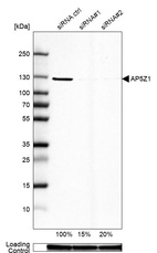 Anti-AP5Z1 Antibody