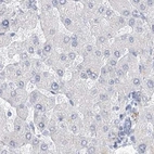 Immunohistochemical staining of human liver using Anti-CSN1S1 antibody HPA035659.