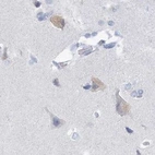 Immunohistochemical staining of human cerebral cortex using Anti-CSN1S1 antibody HPA035659.