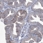 Anti-CES4A Antibody