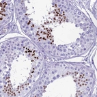 Immunohistochemical staining of human testis shows high expression.