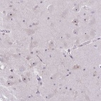 Anti-NIFK Antibody