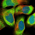 Immunofluorescent staining of human cell line U-2 OS shows localization to cytosol.