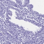 Immunohistochemical staining of human endometrium shows low expression as expected.