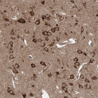 Anti-SERINC1 Antibody