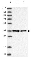 Lane 1: Marker [kDa] 230, 130, 95, 72, 56, 36, 28, 17, 11_br/_Lane 2: Human cell line RT-4_br/_Lane 3: Human cell line U-251 MG