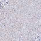 Anti-CES4A Antibody