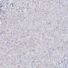 Immunohistochemical staining of human smooth muscles shows no positivity as expected.