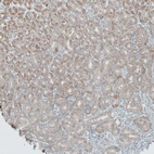 Immunohistochemical staining of human stomach shows moderate cytoplasmic positivity in glandular cells.