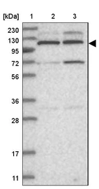 Lane 1: Marker [kDa] 230, 130, 95, 72, 56, 36, 28, 17, 11_br/_Lane 2: Human cell line RT-4_br/_Lane 3: Human cell line U-251MG sp