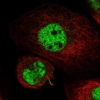 Immunofluorescent staining of human cell line A-431 shows localization to nucleoplasm & cytokinetic bridge.