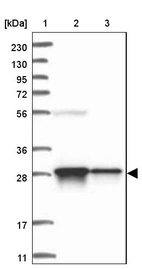 Lane 1: Marker [kDa] 230, 130, 95, 72, 56, 36, 28, 17, 11_br/_Lane 2: Human cell line RT-4_br/_Lane 3: Human cell line U-251MG sp