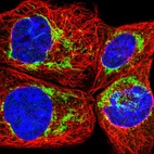 Immunofluorescent staining of human cell line A-431 shows localization to mitochondria.