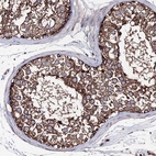 Immunohistochemical staining of human testis shows strong granular cytoplasmic positivity in cells in seminiferous ducts.
