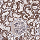 Immunohistochemical staining of human kidney shows moderate granular cytoplasmic positivity in cells in tubules.
