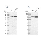 Western blot analysis using Anti-GFM1 antibody HPA034764 (A) shows similar pattern to independent antibody HPA034765 (B).