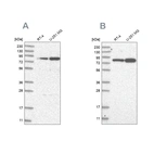Western blot analysis using Anti-GFM1 antibody HPA034764 (A) shows similar pattern to independent antibody HPA034765 (B).