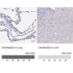 Anti-CACNA2D2 Antibody