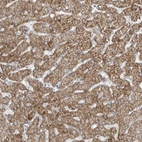 Anti-ADAMTSL3 Antibody