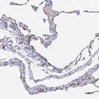 Immunohistochemical staining of human lung shows moderate cytoplasmic positivity in pneumocytes.