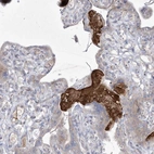 Immunohistochemical staining of human placenta shows strong extracellular space positivity in trophoblastic cells.