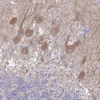 Immunohistochemical staining of human cerebellum shows moderate cytoplasmic positivity in Purkinje cells.