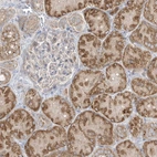 Immunohistochemical staining of human kidney shows strong granular cytoplasmic positivity in cells in tubules.