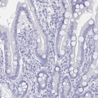 Immunohistochemical staining of human duodenum shows no cytoplasmic positivity in glandular cells.