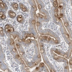 Immunohistochemical staining of human duodenum shows strong cytoplasmic positivity in goblet cells.