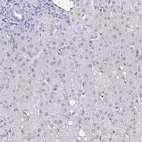 Immunohistochemical staining of human liver shows no cytoplasmic positivity in hepatocytes as expected.