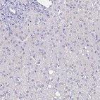 Immunohistochemical staining of human liver shows no cytoplasmic positivity in hepatocytes as expected.