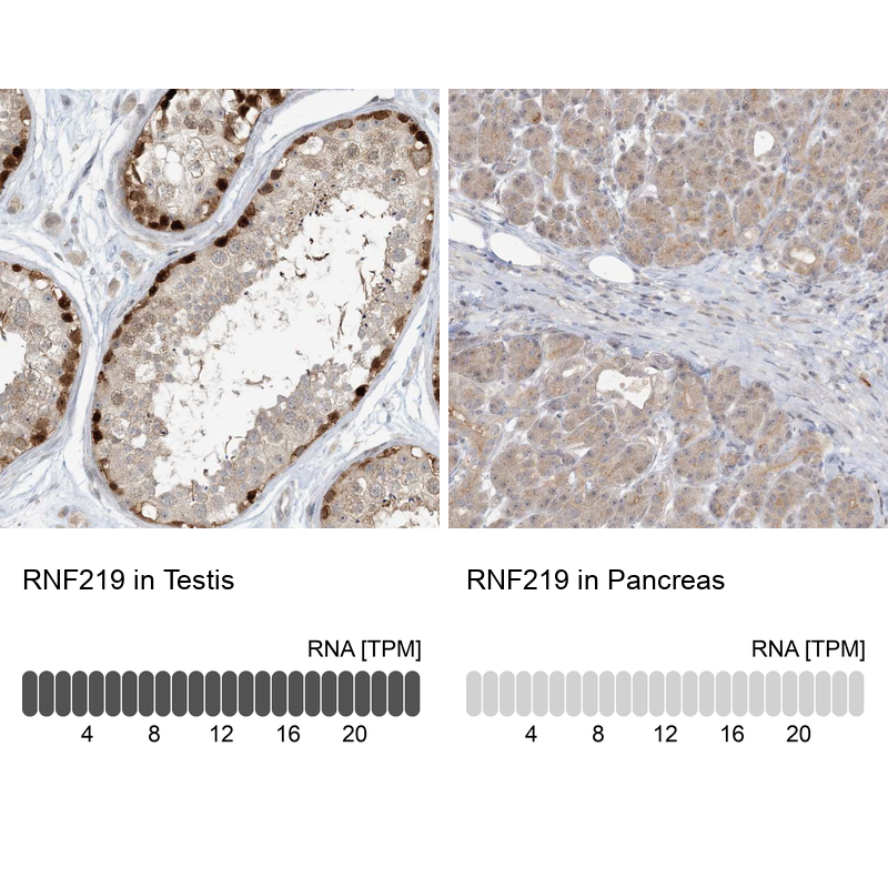 Anti-RNF219 Antibody