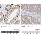 Anti-RNF219 Antibody