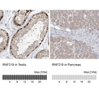 Anti-RNF219 Antibody