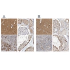 Immunohistochemical staining of human cerebral cortex, kidney, lymph node and testis using Anti-RNF219 antibody HPA034786 (A) shows similar protein distribution across tissues to independent antibody HPA034785 (B).