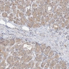 Immunohistochemical staining of human pancreas shows low expression as expected.
